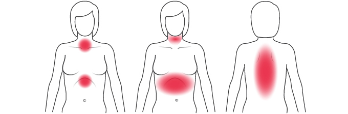 Typical physical signs of a heart attack in women Illustration of common physical signs of heart attack signs in women