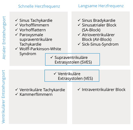 Häufige Arrhythmien Eine Tabelle mit häufige Arrhythmien