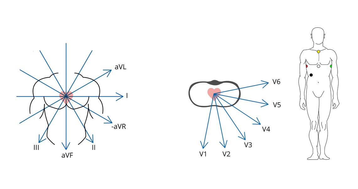 Spatial vectors of a 12-lead-ECG recorded via the specific attachment points of an EASI ECG Image of spatial vectors of a 12-lead-ECG recorded via the specific attachment points of an EASI ECG