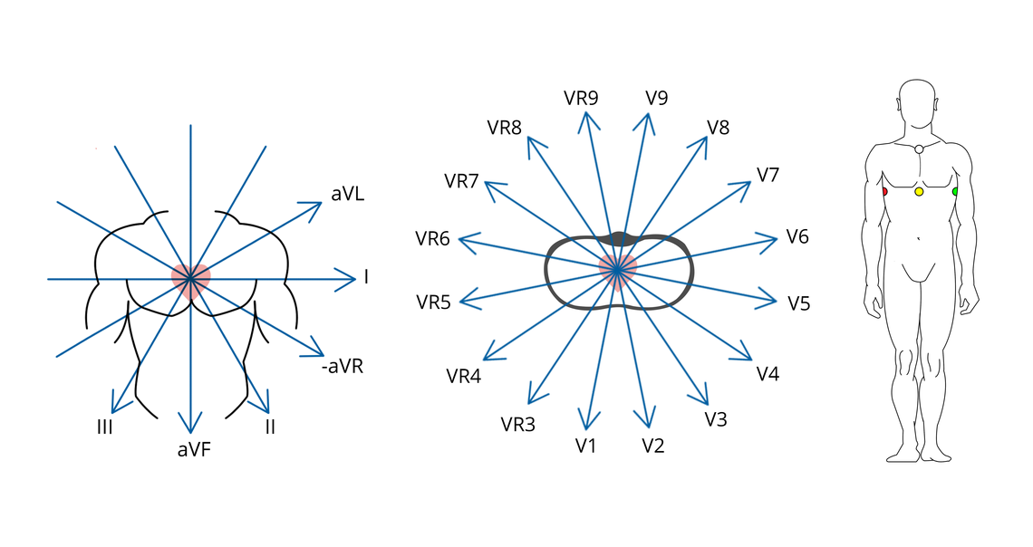 Spatial vectors of a 12-lead-ECG recorded via the specific attachment points of a CardioSecur ECG Image of spatial vectors of a 12-lead-ECG recorded via the specific attachment points of a CardioSecur ECG
