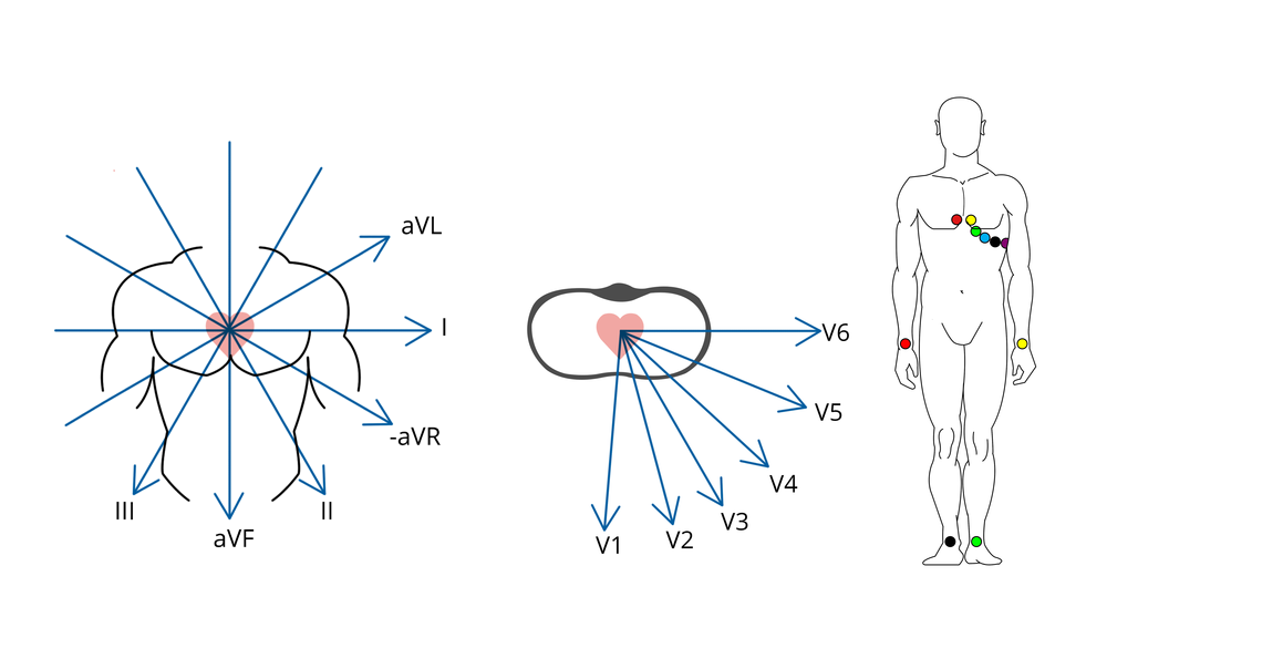Spatial vectors of a 12-lead-ECG with the specified attachment points Image of spatial vectors of a 12-lead-ECG with the specified attachment points