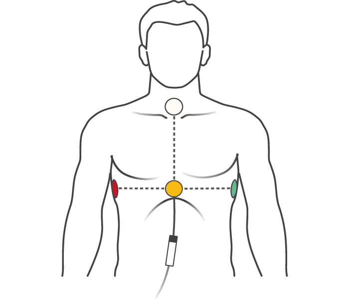 Attach the electrodes to your upper body as shown Image of position of electrodes on upper body