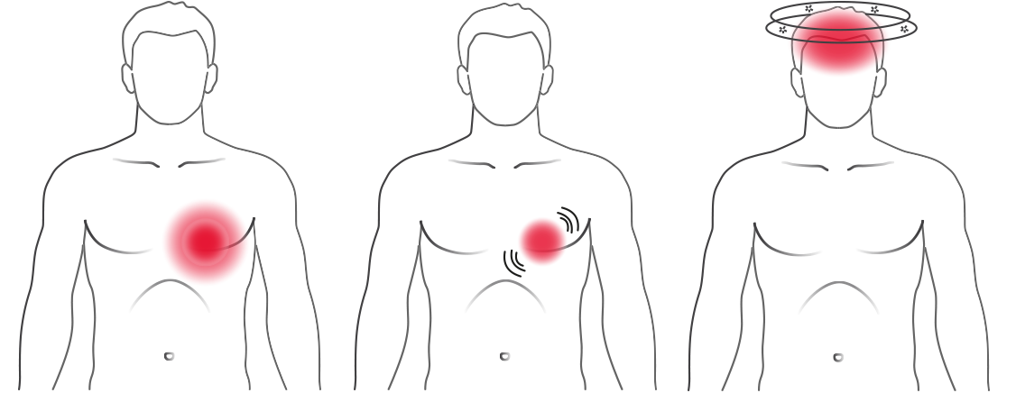 Image: typical symptoms of arrhythmias 