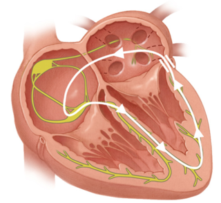 Electrical impulses in the heart muscle Diagram of electrical impulses in the heart muscle